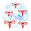 OAD Unterus Feltie 2000 Uterus Feltie